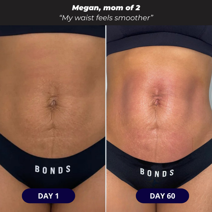 Themytom Pro Red Light Therapy Belt - Pain Relief, Skin Tightening & Wrinkle Support