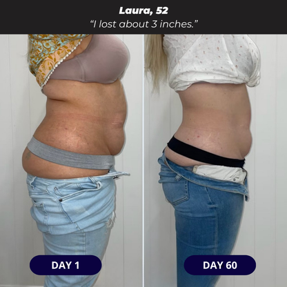 Themytom Pro Red Light Therapy Belt - Pain Relief, Skin Tightening & Wrinkle Support